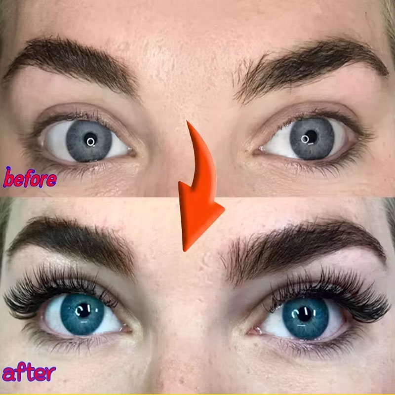 Fast Eyelash Growth Serum 7 วั - Lash Serum Growth บทวิจารณ์และราคา