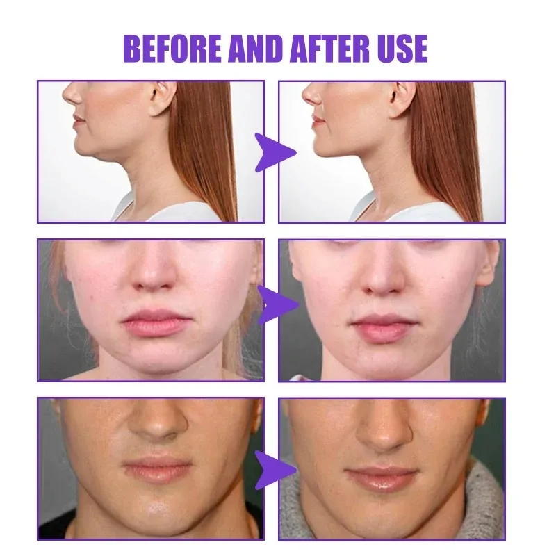 Face-Liftครีมกระชับสัดส่วนSlim - Anti-Aging Face Cream บทวิจารณ์และราคา